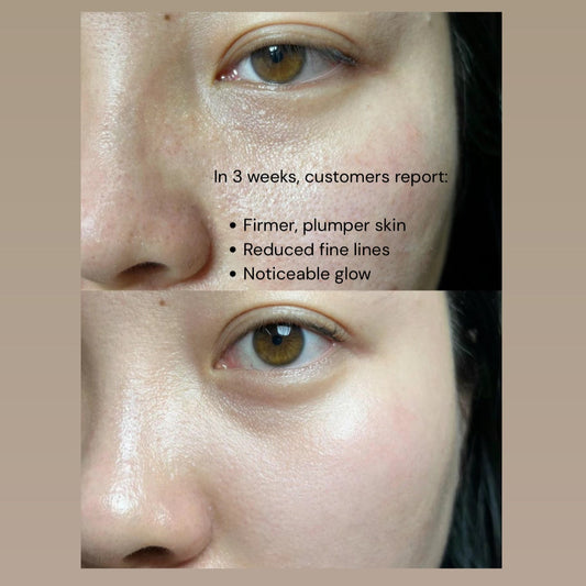 Award-Winning #1  in Clean Beauty - The Collagen Rebirth Trio